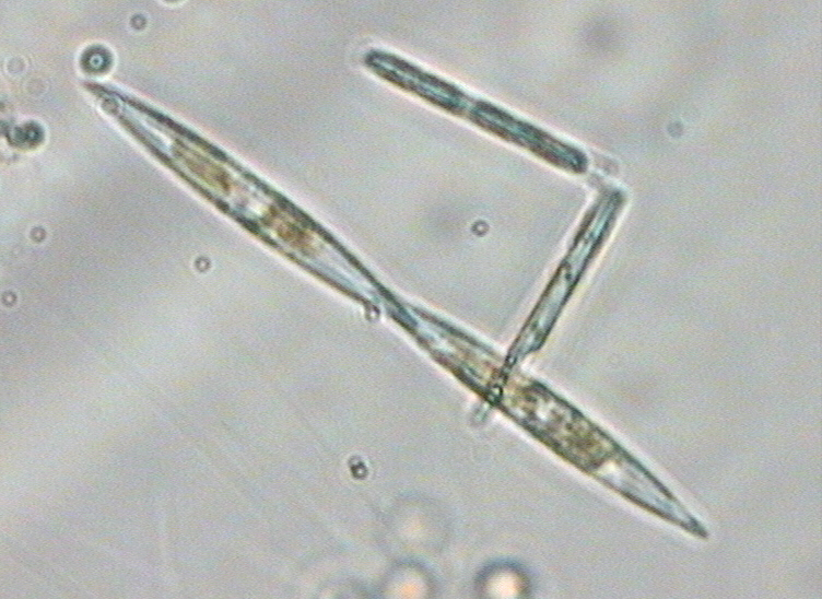 Dictyocha speculum